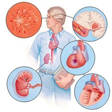 Cardiol prévient le développement de comorbidités